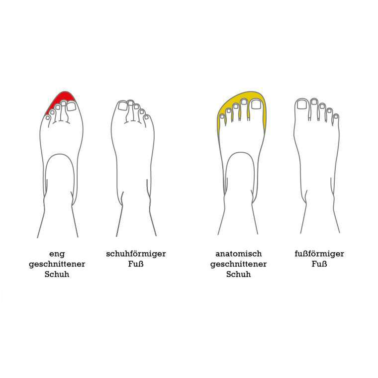 COMPROMISED FEET: NATURE OR NURTURE?