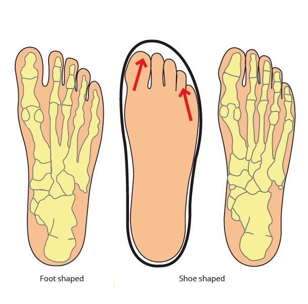 THE SCIENCE OF FOOT DYSFUNCTION AND CURE